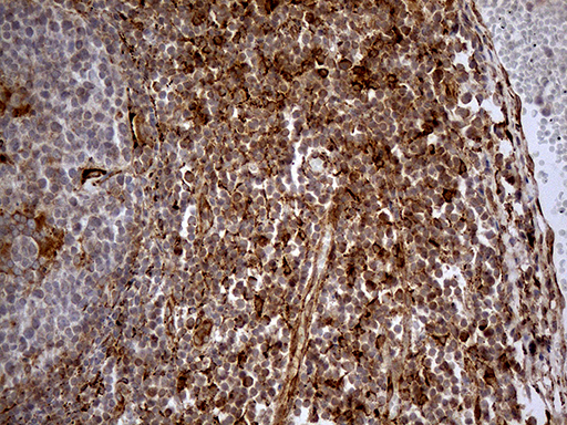 KDELC2 Antibody - Immunohistochemical staining of paraffin-embedded Human tonsil within the normal limits using anti-KDELC2 mouse monoclonal antibody. (Heat-induced epitope retrieval by 1mM EDTA in 10mM Tris buffer. (pH8.5) at 120°C for 3 min. (1:150)