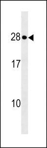 KDELR1 / HDEL Antibody - KDELR1 Antibody western blot of MCF-7 cell line lysates (35 ug/lane). The KDELR1 antibody detected the KDELR1 protein (arrow).