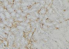 KDELR1 / HDEL Antibody - 1:100 staining mouse kidney tissue by IHC-P. The sample was formaldehyde fixed and a heat mediated antigen retrieval step in citrate buffer was performed. The sample was then blocked and incubated with the antibody for 1.5 hours at 22°C. An HRP conjugated goat anti-rabbit antibody was used as the secondary.