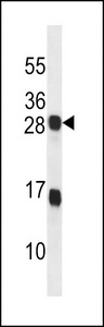 KDELR2 Antibody - KDELR2 Antibody western blot of T47D cell line lysates (35 ug/lane). The KDELR2 antibody detected the KDELR2 protein (arrow).
