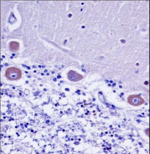 KDELR2 Antibody - KDELR2 Antibody immunohistochemistry of formalin-fixed and paraffin-embedded human cerebellum tissue followed by peroxidase-conjugated secondary antibody and DAB staining.
