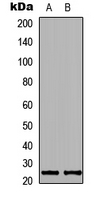 KDELR2 Antibody - Western blot analysis of KDELR2 expression in SHSY5Y (A); NIH3T3 (B) whole cell lysates.