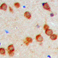 KDELR2 Antibody - Immunohistochemical analysis of KDELR2 staining in human brain formalin fixed paraffin embedded tissue section. The section was pre-treated using heat mediated antigen retrieval with sodium citrate buffer (pH 6.0). The section was then incubated with the antibody at room temperature and detected using an HRP conjugated compact polymer system. DAB was used as the chromogen. The section was then counterstained with hematoxylin and mounted with DPX.