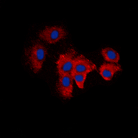 KDELR2 Antibody - Immunofluorescent analysis of KDELR2 staining in A549 cells. Formalin-fixed cells were permeabilized with 0.1% Triton X-100 in TBS for 5-10 minutes and blocked with 3% BSA-PBS for 30 minutes at room temperature. Cells were probed with the primary antibody in 3% BSA-PBS and incubated overnight at 4 deg C in a humidified chamber. Cells were washed with PBST and incubated with a DyLight 594-conjugated secondary antibody (red) in PBS at room temperature in the dark. DAPI was used to stain the cell nuclei (blue).