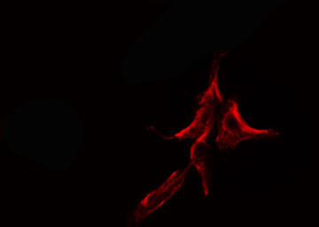 KDELR2 Antibody - Staining HuvEc cells by IF/ICC. The samples were fixed with PFA and permeabilized in 0.1% Triton X-100, then blocked in 10% serum for 45 min at 25°C. The primary antibody was diluted at 1:200 and incubated with the sample for 1 hour at 37°C. An Alexa Fluor 594 conjugated goat anti-rabbit IgG (H+L) antibody, diluted at 1/600, was used as secondary antibody.