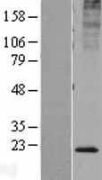 KDELR2 Protein - Western validation with an anti-DDK antibody * L: Control HEK293 lysate R: Over-expression lysate