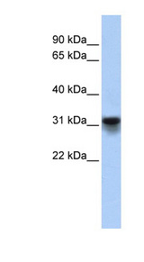 KDELR3 Antibody - KDELR3 antibody Western blot of Fetal Heart lysate. This image was taken for the unconjugated form of this product. Other forms have not been tested.