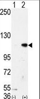 KDM1A / LSD1 Antibody - Western blot of AOF2 (arrow) using LSD1 Antibody. 293 cell lysates (2 ug/lane) either nontransfected (Lane 1) or transiently transfected with the AOF2 gene (Lane 2) (Origene Technologies).