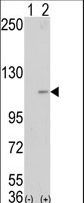 KDM1A / LSD1 Antibody - Western blot of AOF2 (arrow) using LSD1 Antibody. 293 cell lysates (2 ug/lane) either nontransfected (Lane 1) or transiently transfected with the AOF2 gene (Lane 2) (Origene Technologies).
