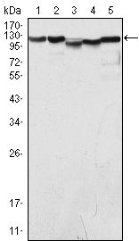 KDM1A / LSD1 Antibody - LSD1 Antibody in Western Blot (WB)