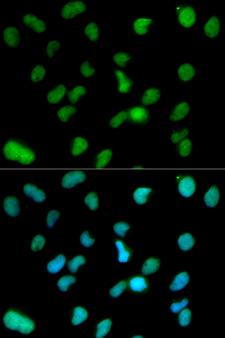 KDM1A / LSD1 Antibody - Immunofluorescence analysis of HeLa cells.