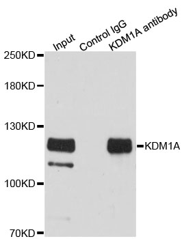 KDM1A / LSD1 Antibody - Immunofluorescence analysis of A549 cells using KDM1A antibody.