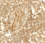 KDM1A / LSD1 Antibody - Immunohistochemistry of LSD1 in human spleen tissue with LSD1 antibody at 5 ug/mL.