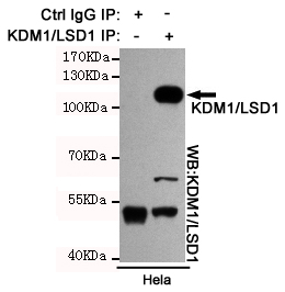 KDM1A / LSD1 Antibody - Immunoprecipitation analysis of HeLa cell lysates using KDM1/LSD1 mouse monoclonal antibody.