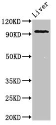 KDM1A / LSD1 Antibody - Western Blot Positive WB detected in: mouse liver All Lanes: KDM1A antibody at 2ug/ml Secondary Goat polyclonal to rabbit IgG at 1/50000 dilution Predicted band size: 93,96 kDa Observed band size: 93 kDa