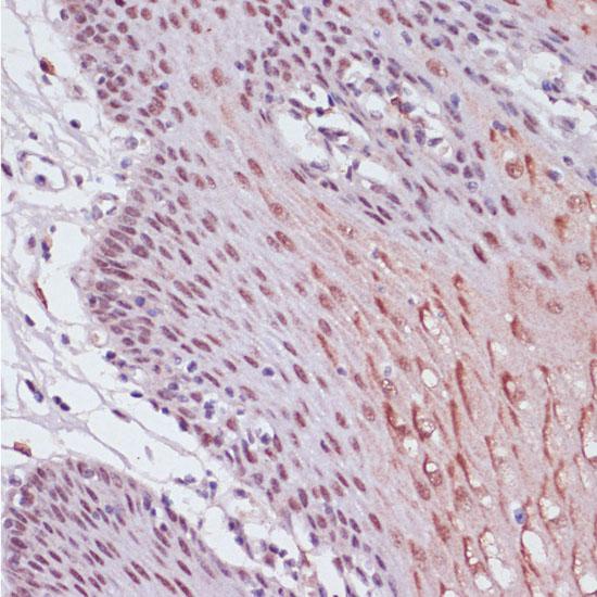 KDM1A / LSD1 Antibody - Immunohistochemistry of paraffin-embedded Human esophageal using KDM1 Polyclonal Antibody at dilution of 1:100 (40x lens).