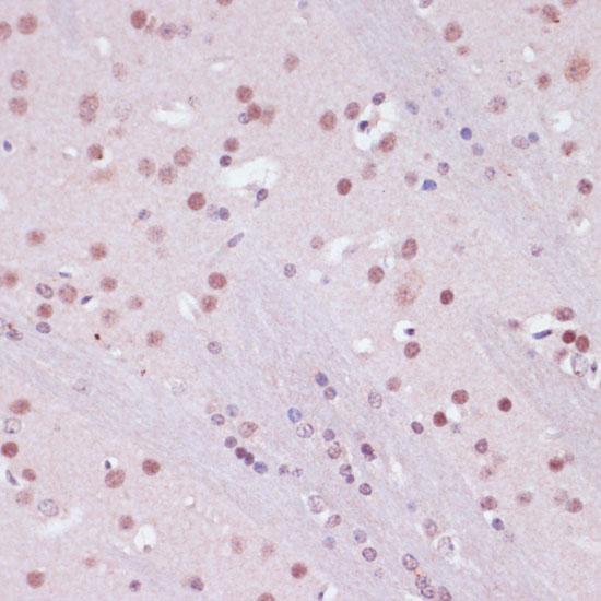KDM1A / LSD1 Antibody - Immunohistochemistry of paraffin-embedded Mouse brain using KDM1 Polyclonal Antibody at dilution of 1:100 (40x lens).