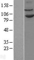 KDM1A / LSD1 Protein - Western validation with an anti-DDK antibody * L: Control HEK293 lysate R: Over-expression lysate