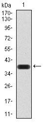 KDM1B Antibody - Western blot analysis using AOF1 mAb against human AOF1 (AA: 6-129) recombinant protein. (Expected MW is 40 kDa)