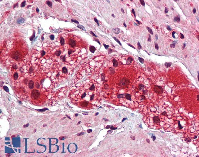 KDM2B / FBXL10 Antibody - Anti-KDM2B antibody IHC of human colon, myenteric plexus. Immunohistochemistry of formalin-fixed, paraffin-embedded tissue after heat-induced antigen retrieval. Antibody concentration 5 ug/ml.  This image was taken for the unconjugated form of this product. Other forms have not been tested.