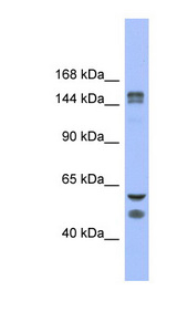 KDM2B / FBXL10 Antibody - KDM2B / FBXL10 antibody Western blot of Fetal Stomach lysate. This image was taken for the unconjugated form of this product. Other forms have not been tested.
