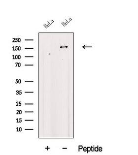 KDM2B / FBXL10 Antibody - Western blot analysis of extracts of HeLa cells using KDM2B antibody. The lane on the left was treated with blocking peptide.