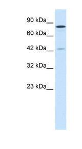 KDM3A / JMJD1A Antibody - KDM3A / JMJD1A antibody ARP32911_T100-NP_060903-JMJD1A (jumonji domain containing 1A) Antibody Western blot of Jurkat lysate.  This image was taken for the unconjugated form of this product. Other forms have not been tested.