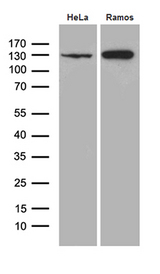 KDM3A / JMJD1A Antibody - Western blot analysis of extracts. (35ug) from 2 cell lines by using anti-KDM3A monoclonal antibody. (1:500)