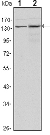 KDM3A / JMJD1A Antibody - Western blot using KDM3A mouse monoclonal antibody against HeLa (1) and HepG2 (2) cell lysate.