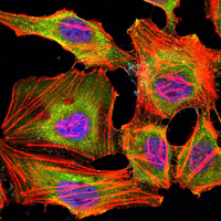KDM3A / JMJD1A Antibody - Immunofluorescence of HeLa cells using KDM3A mouse monoclonal antibody (green). Blue: DRAQ5 fluorescent DNA dye. Red: Actin filaments have been labeled with Alexa Fluor-555 phalloidin.