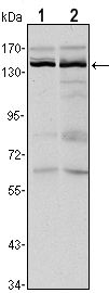 KDM3A / JMJD1A Antibody - JMJD1A Antibody in Western Blot (WB)