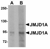 KDM3A / JMJD1A Antibody - Western blot of JMJD1A in mouse liver tissue lysate with JMJD1A antibody at (A) 1 and (B) 2 ug/ml. Below: Immunohistochemistry of JMJD1A in rat liver tissue with JMJD1A antibody at 5 ug/ml.