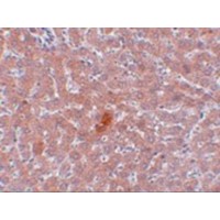 KDM3A / JMJD1A Antibody - Immunohistochemistry of JMJD1A in rat liver tissue with JMJD1A antibody at 5 µg/mL.