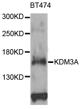 KDM3A / JMJD1A Antibody - Western blot analysis of extracts of BT474 cells.