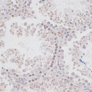 KDM3A / JMJD1A Antibody - Immunohistochemistry of paraffin-embedded mouse testis using KDM3A antibody at dilution of 1:100 (40x lens).