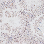 KDM3A / JMJD1A Antibody - Immunohistochemistry of paraffin-embedded mouse testis using KDM3A antibody at dilution of 1:100 (40x lens).