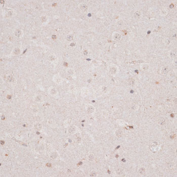 KDM3A / JMJD1A Antibody - Immunohistochemistry of paraffin-embedded mouse brain using KDM3A antibody at dilution of 1:100 (40x lens).