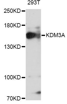KDM3A / JMJD1A Antibody - Western blot analysis of extracts of 293T cells, using KDM3A Antibody at 1:1000 dilution. The secondary antibody used was an HRP Goat Anti-Rabbit IgG (H+L) at 1:10000 dilution. Lysates were loaded 25ug per lane and 3% nonfat dry milk in TBST was used for blocking. An ECL Kit was used for detection and the exposure time was 90s.