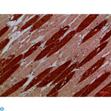 KDM3A / JMJD1A Antibody - Immunohistochemical analysis of paraffin-embedded human-skeletal-muscle, antibody was diluted at 1:100.