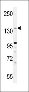 KDM3B / JMJD1B Antibody - JHDM2b Antibody western blot of mouse heart tissue lysates (35 ug/lane). The JHDM2b antibody detected the JHDM2b protein (arrow).