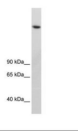 KDM3B / JMJD1B Antibody - Fetal Thymus Lysate.  This image was taken for the unconjugated form of this product. Other forms have not been tested.