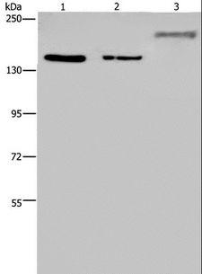 KDM3B / JMJD1B Antibody - Western blot analysis of HeLa and 293T cell, mouse skeletal muscle tissue, using KDM3B Polyclonal Antibody at dilution of 1:1000.