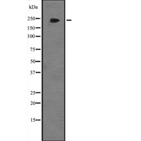 KDM3B / JMJD1B Antibody - Western blot analysis of JMJD1B expression in HeLa cells lysate. The lane on the left is treated with the antigen-specific peptide.