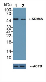 KDM4A / JHDM3A / JMJD2A Antibody - Knockout Varification: Lane 1: Wild-type MCF7 cell lysate; Lane 2: KDM4A knockout MCF7 cell lysate; Predicted MW: 120,54kd Observed MW: 50kd Primary Ab: 2µg/ml Rabbit Anti-Human KDM4A Antibody Second Ab: 0.2µg/mL HRP-Linked Caprine Anti-Rabbit IgG Polyclonal Antibody