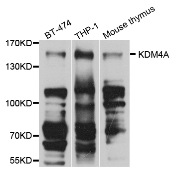 KDM4A / JHDM3A / JMJD2A Antibody - Western blot analysis of extract of various cells.