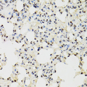 KDM4A / JHDM3A / JMJD2A Antibody - Immunohistochemistry of paraffin-embedded mouse lung tissue.