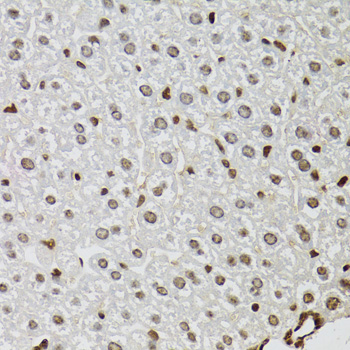 KDM4A / JHDM3A / JMJD2A Antibody - Immunohistochemistry of paraffin-embedded mouse liver tissue.