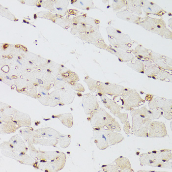 KDM4A / JHDM3A / JMJD2A Antibody - Immunohistochemistry of paraffin-embedded mouse heart tissue.