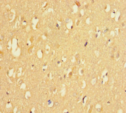 KDM4A / JHDM3A / JMJD2A Antibody - Immunohistochemistry of paraffin-embedded human brain tissue at dilution of 1:100