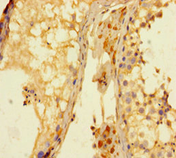 KDM4A / JHDM3A / JMJD2A Antibody - Immunohistochemistry of paraffin-embedded human testis tissue at dilution of 1:100